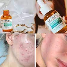 Balance Active Formula Niacinamide Blemish Recovery Serum Calm & Clear, 30ml